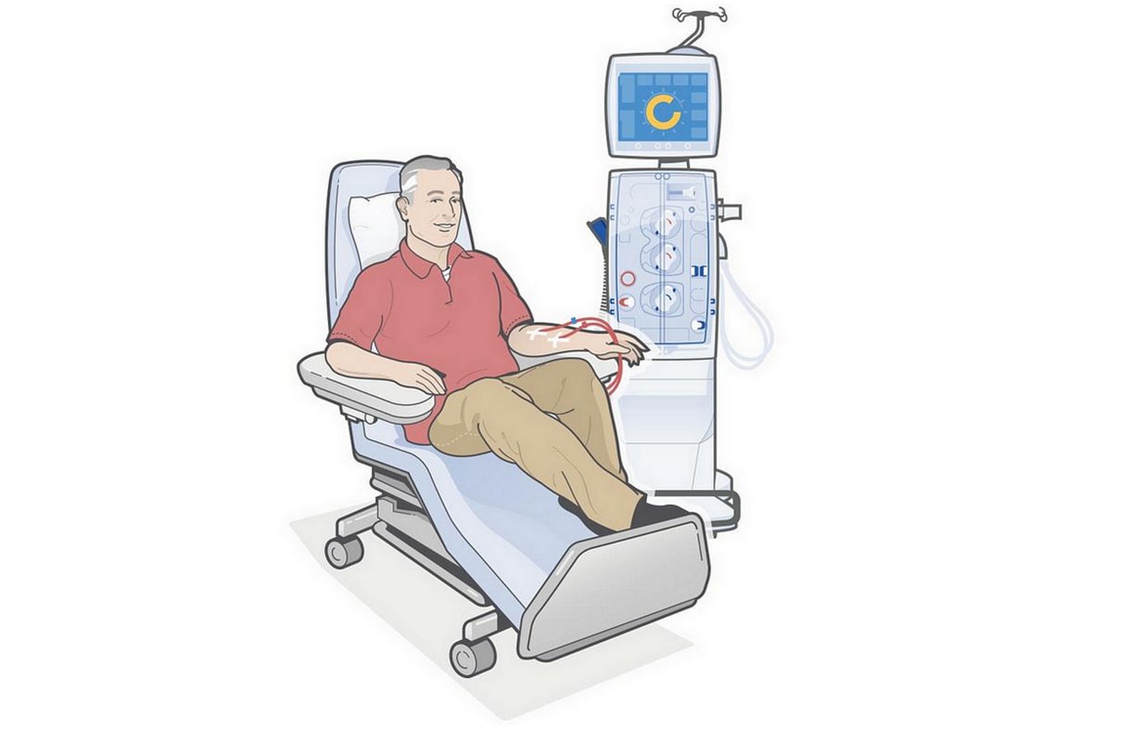 Patient får hemodialysbehandling (illustration)