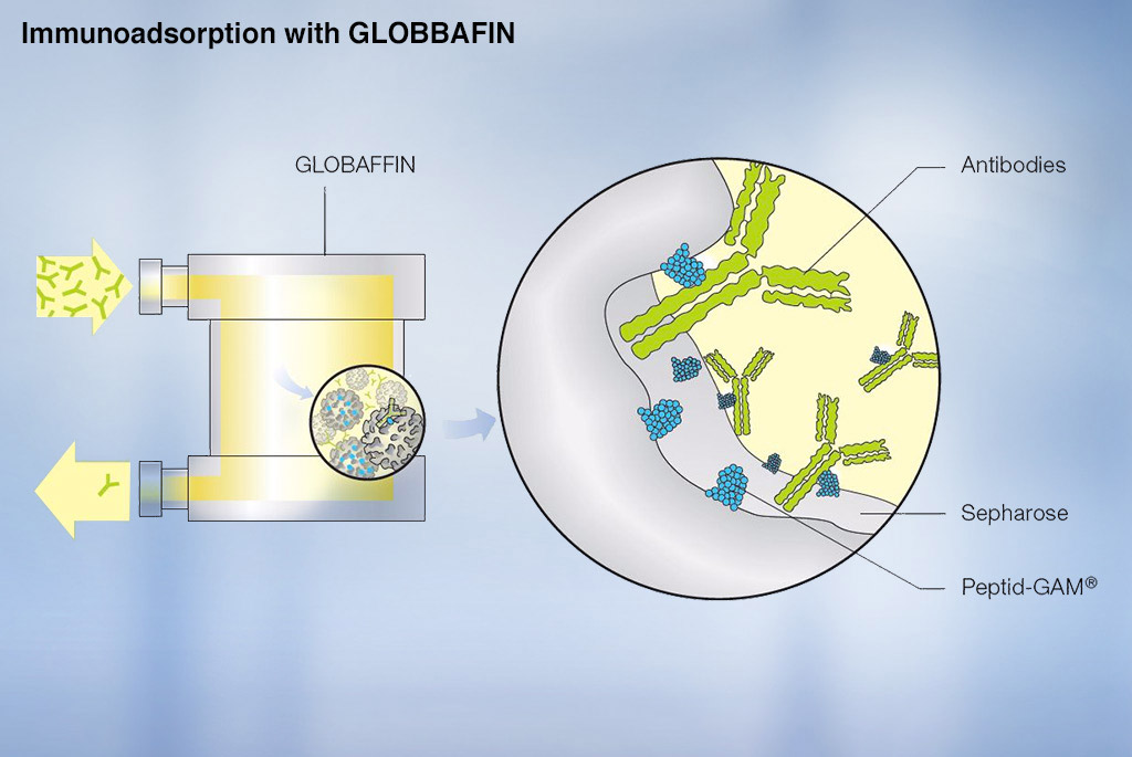 Immunoadsorption med GLOBAFFIN