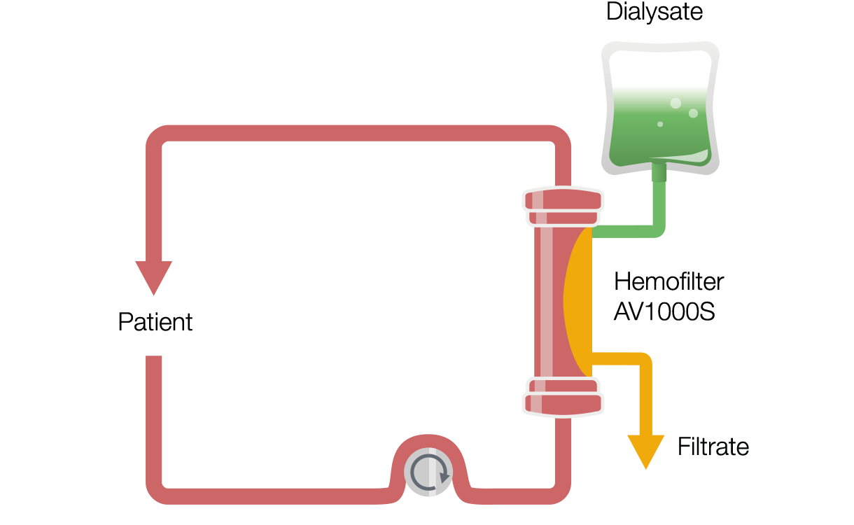 Kontinuerlig venovenös hemodialys (CVVHD)